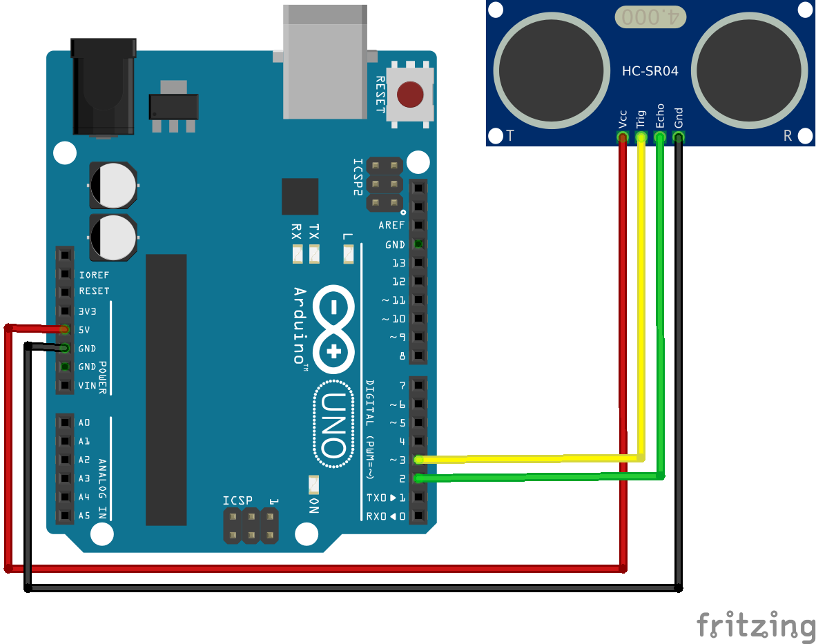 Ulstrasonic image